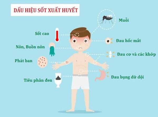 Triệu chứng sốt xuất huyết ở trẻ em