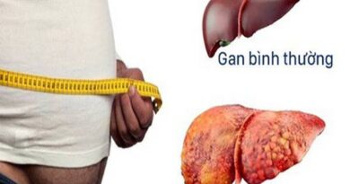 Chia sẻ cách phòng bệnh gan nguy hiểm đến sức khỏe