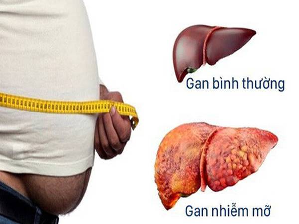 
Chia sẻ cách phòng bệnh gan nguy hiểm đến sức khỏe
