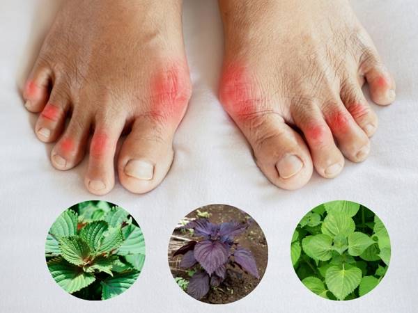 Mách bạn cách chữa bệnh gout bằng lá tía tô hiệu quả