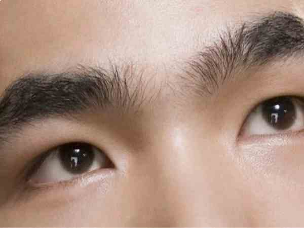  Trán có ấn hẹp và tối
