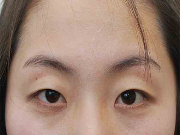 tướng mắt hạc