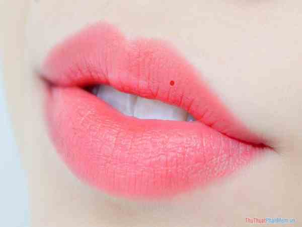 Nốt ruồi son ở giữa môi trên