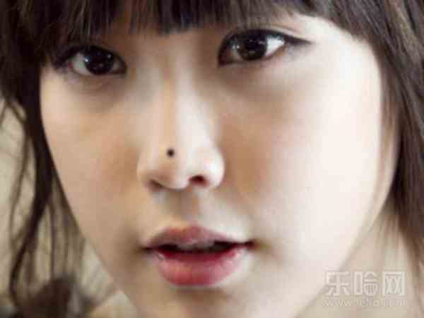 Nốt ruồi ở đầu mũi