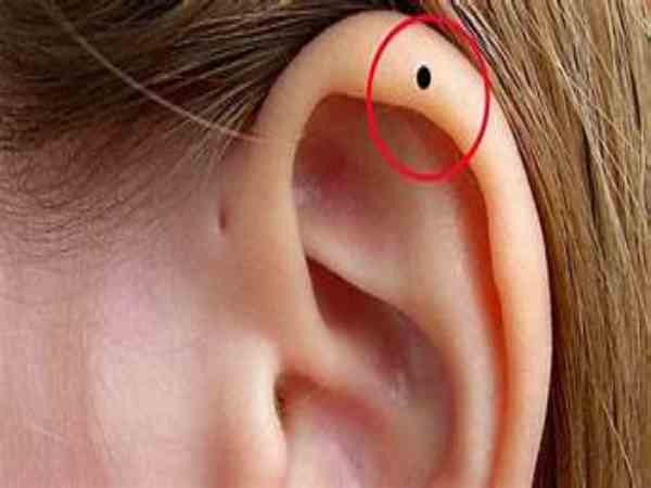  Nốt ruồi ở vành tai bên trái của nữ