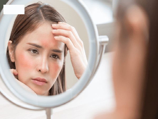 Đặc điểm làn da nhạy cảm